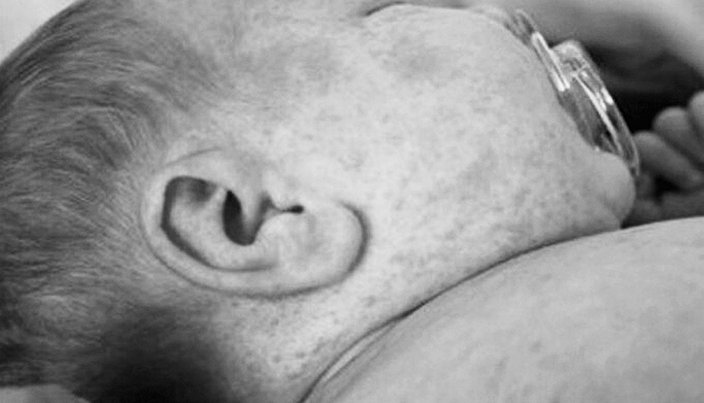 Vissmagākajā formā ar masalām slimo pieaugušie, kā arī bērni līdz viena gada vecumam. Tāpat slimība ir bīstama grūtniecēm, jo var izraisīt augļa bojāeju vai priekšlaicīgas dzemdības.