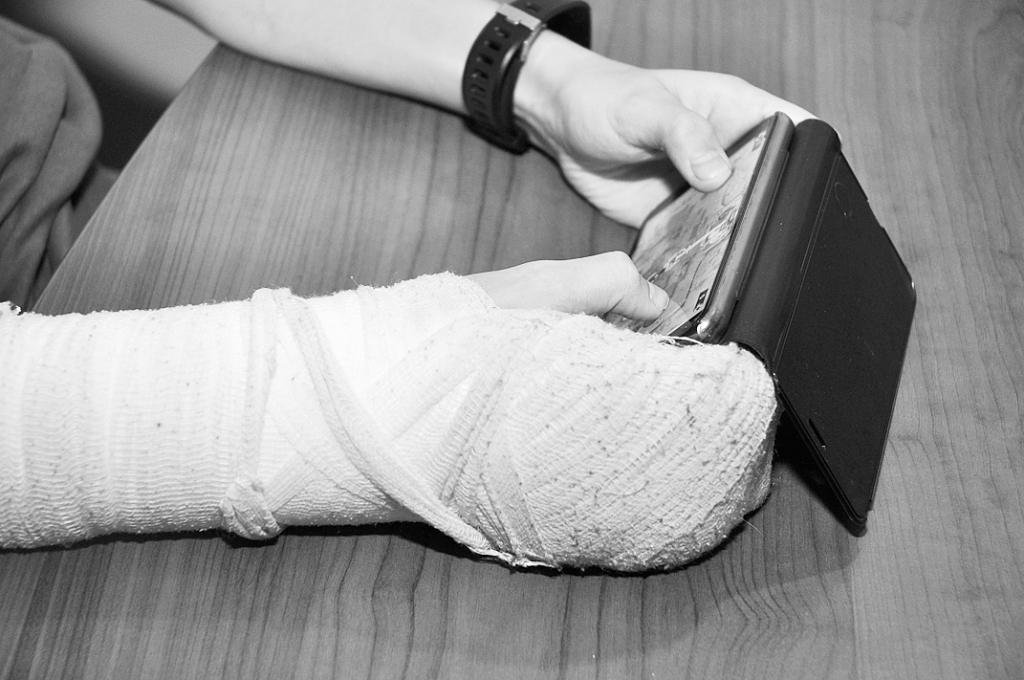 Ja šķiet, ka kauli lūst pārāk viegli, vispirms noteikti jākonsultējas ar ģimenes ārstu. Tas var nosūtīt pie ortopēda, endokrinologa, ja ir aizdomas par vielmaiņas traucējumiem, vai ģenētiķa, ja iemesls varētu būt iedzimta kaulu problēma.
Autors: Daiņa Ģelža foto